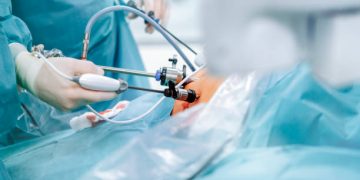 Bariatric Surgery In Florida 