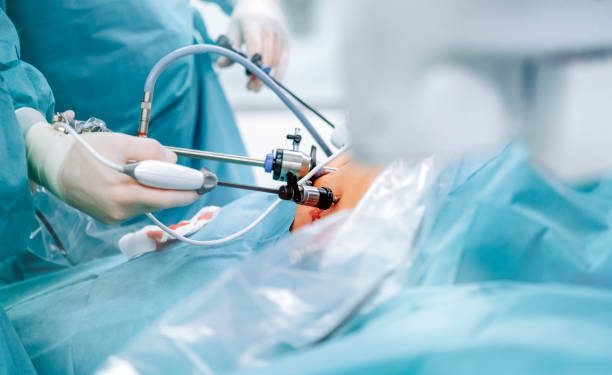 Bariatric Surgery In Florida 